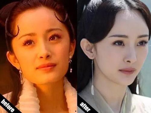 明星故意伸下巴,揭秘故意伸下巴的时尚潮流